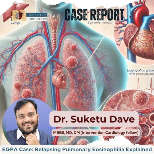 relapsing-pulmonary-eosinophilia-as-the-initial-manifestation-of-egpa-The-Aartery-Chronicles-TAC