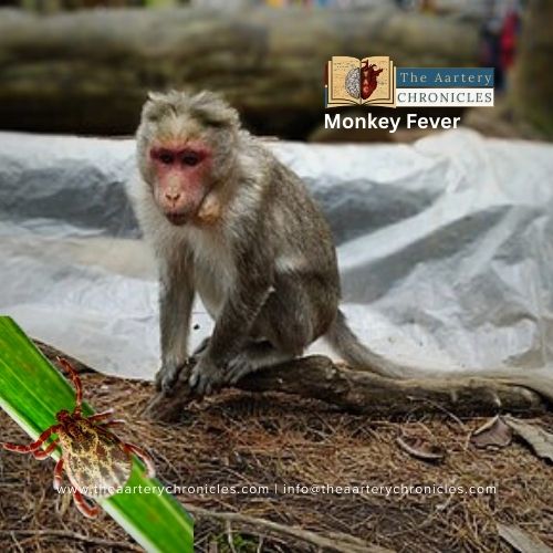 Kyasanur Forest Disease (KFD): The Enigma of Monkey Fever