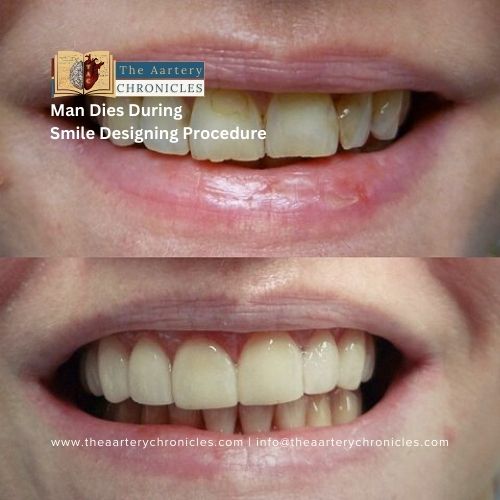 Smile design procedure