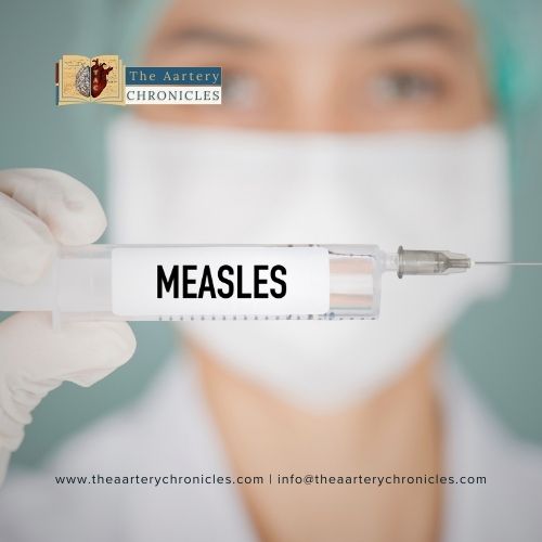 measles-The-Aartery-chronicles-TAC