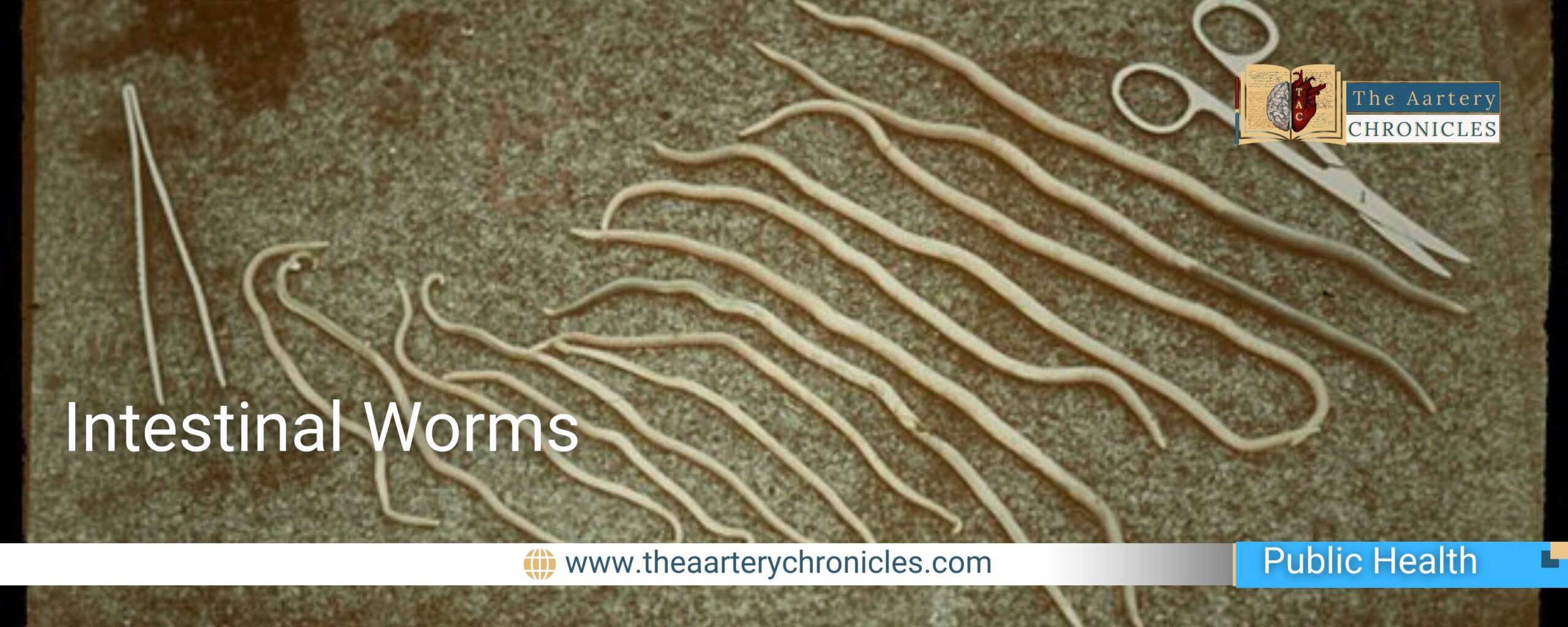 Intestinal-Worms-the-aaartery-chronicles-tac