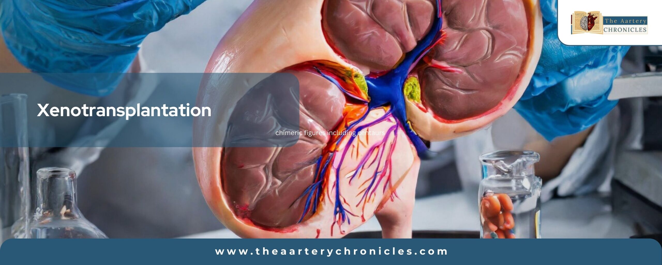 xenotransplantation-the-aaartery-chronicles-tac