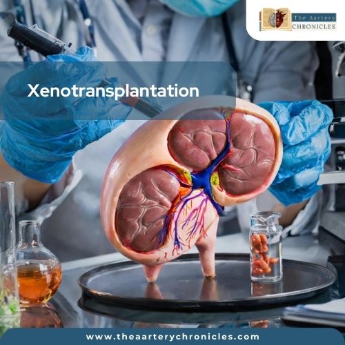 Xenotransplantation: History, Advances, and Ethical Considerations