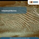 Intestinal-Worms-the-aaartery-chronicles-tac