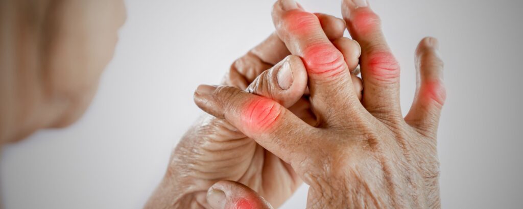 Arthritis-Symptoms-Types-and-management-the-aartery-chronicles-tac