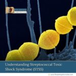 Understanding-Streptococcal-Toxic-Shock-Syndrome-(STSS)-The-Aartery-Chronicles-TAC