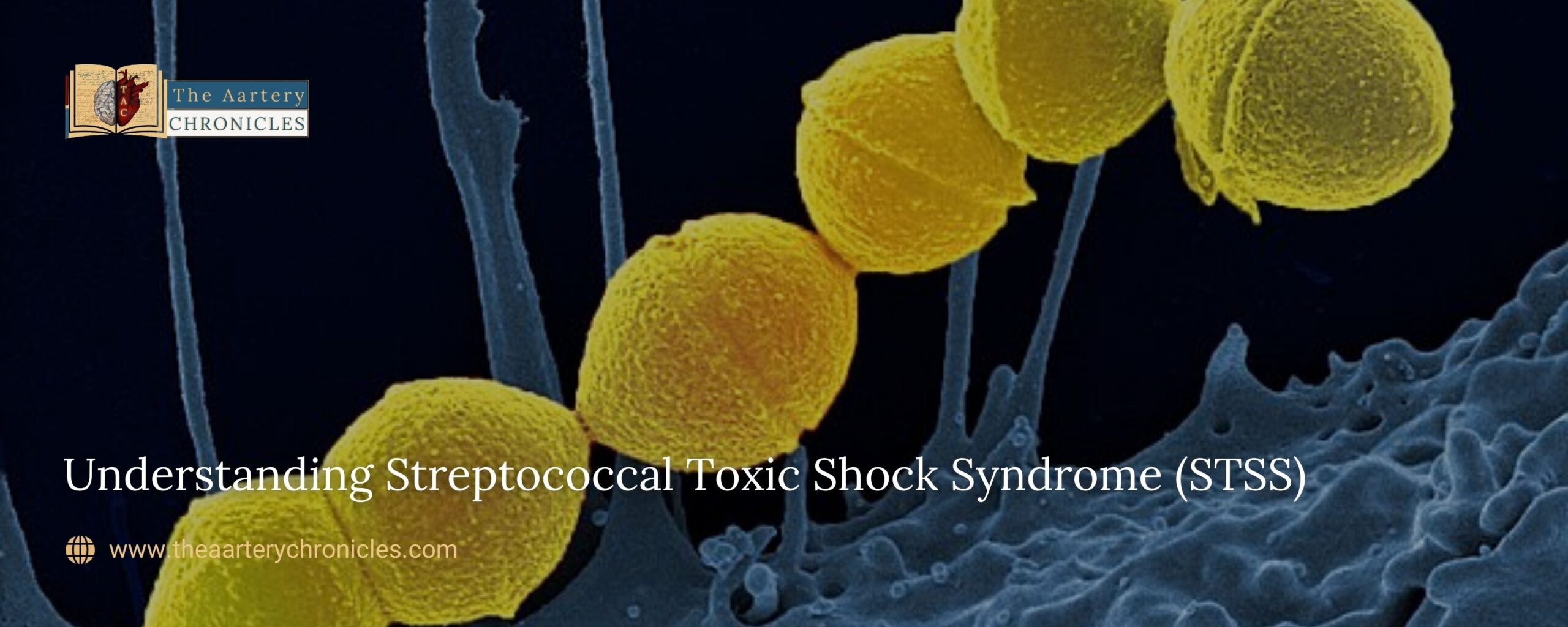 Understanding-Streptococcal-Toxic-Shock-Syndrome-(STSS)-The-Aartery-Chronicles-TAC