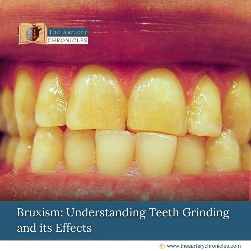 Bruxism:-Understanding-Teeth-Grinding-and-its-Effects-The-Aartery-Chronicles-TAC
