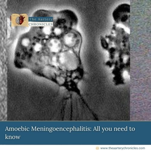 Amoebic Meningoencephalitis: All you need to know