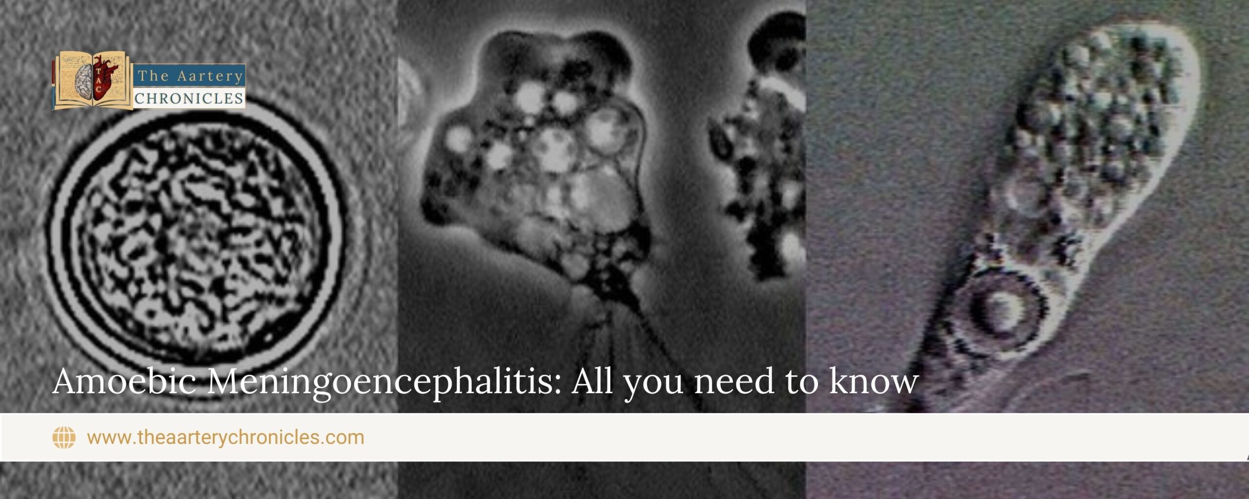 Amoebic-Meningoencephali-is:-All-you-need-to-know-The-Aartery-Chronicles-TAC