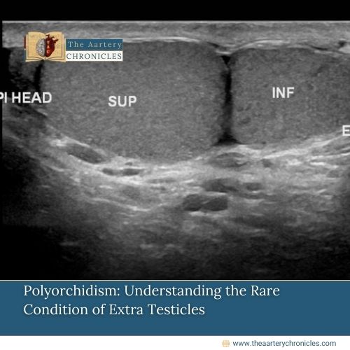 Polyorchidism:-Understanding-the-Rare-Condition-of-Extra-Testicles-The-Aartery-Chronicles-TAC