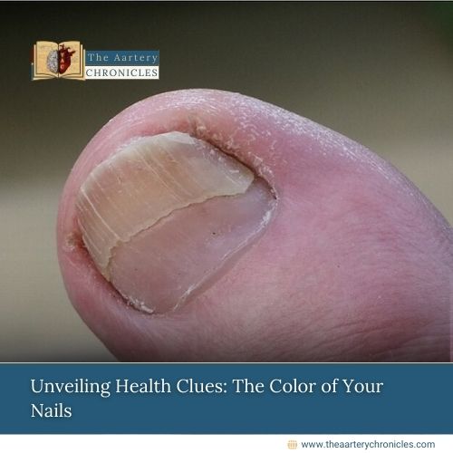 Unveiling-Health-Clues:-The-Color-of-Your-Nails-The-Aartery-Chronicles-TAC