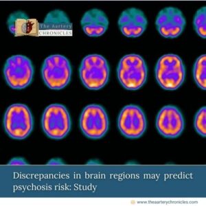 Discrepancies-in-brain-regions-may-predict-psychosis-risk:-Study-The-Aartery-Chronicles-TAC