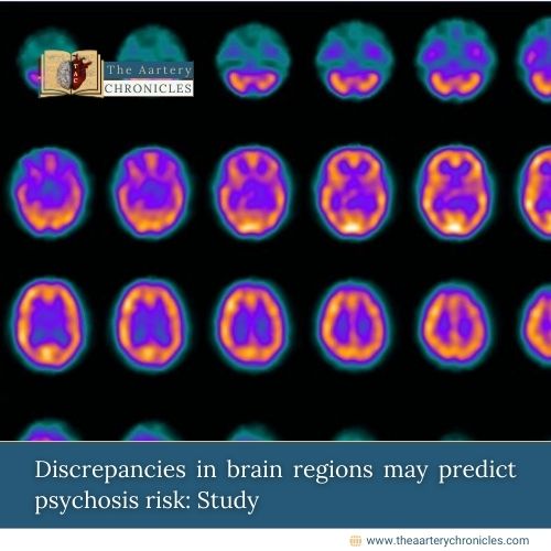 Discrepancies in brain regions may predict psychosis risk: Study