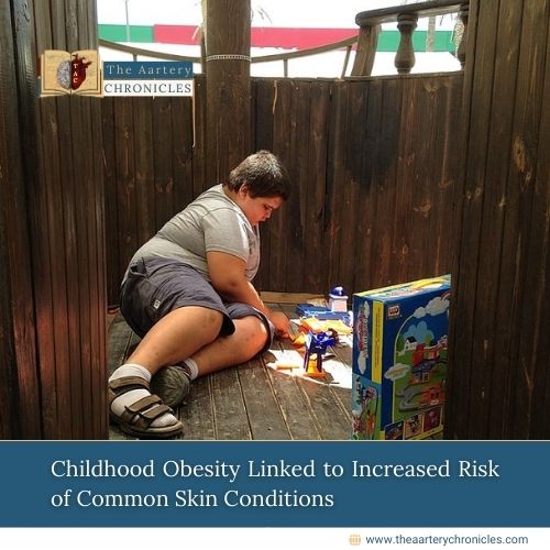 Childhood Obesity Linked to Increased Risk of Common Skin Conditions