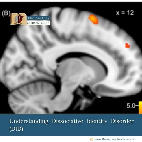 Dissociative Identity Disorder (DID): All You Need to Know