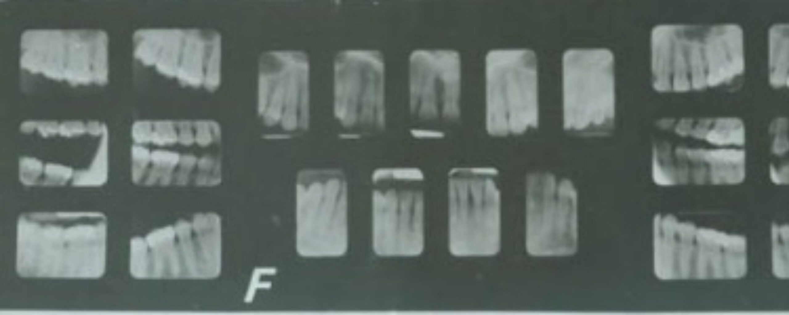 Forensic-Odontology:-An-Essential-Tool-in-Criminal-Investigations-The-Aartery-Chronicles-TAC