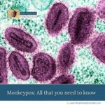 Mpox-(Monkeypox):-Comprehensive-Review-of-Symptoms,-Transmission,-and-Treatment-The-Aartery-TAC