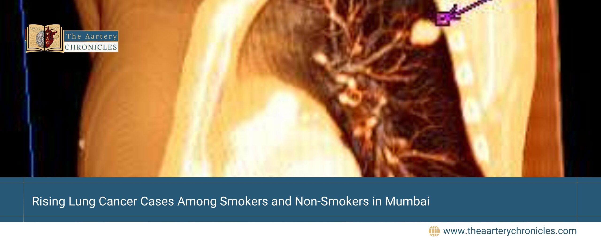 Rising-Lung-Cancer-Cases-Among-Smokers-and-Non-Smokers-in-Mumbai-The-Aartery-Chronicles-TAC