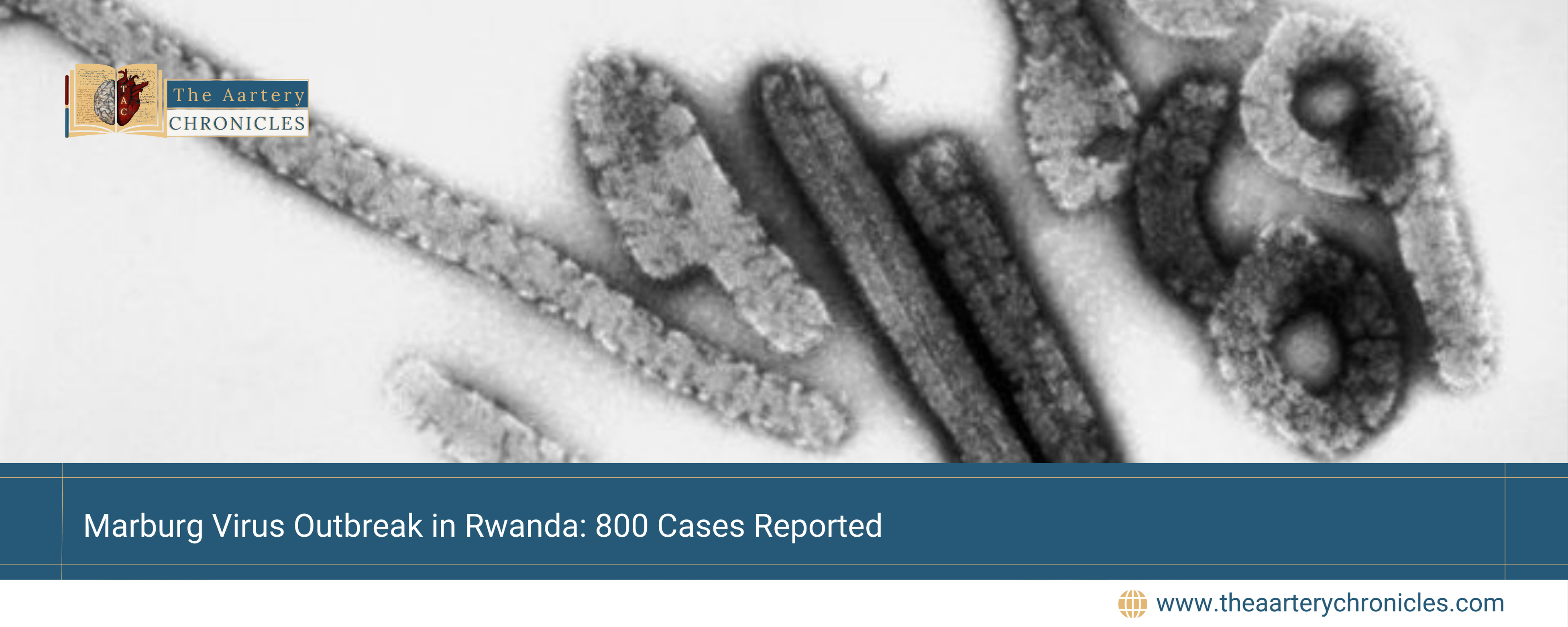 Marburg-Virus-Outbreak-in-Rwanda:-800-Cases-Reported-The-Aartery-Chronicles-TAC