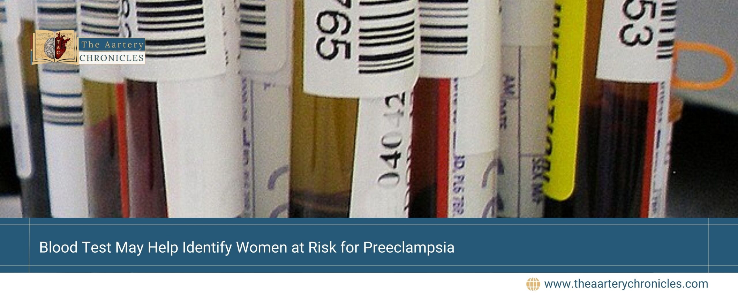 Blood-Test-May-Help-Identify-Women-at-Risk-for-Preeclampsia-The-Aartery-Chronicles-TAC