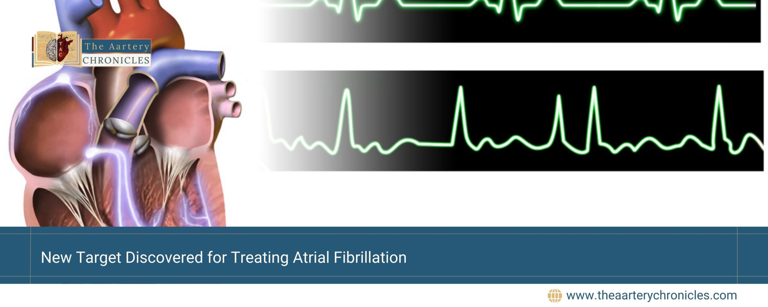 New-Target-Discovered-for-Treating-Atrial-Fibrillation-The-Aartery-Chronicles-TAC