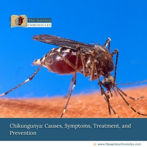 Chikungunya: All that you need to know