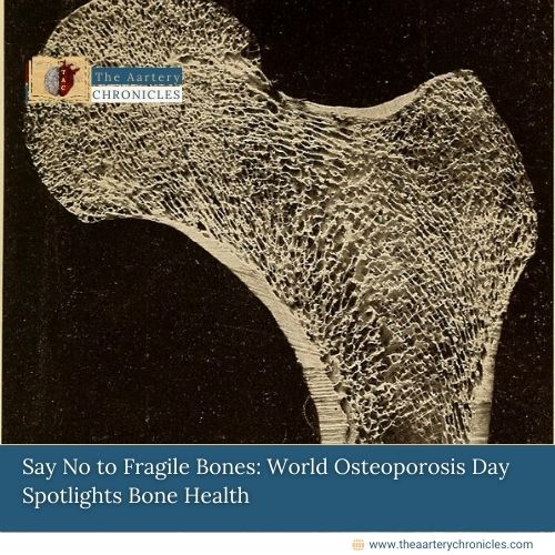 Say No to Fragile Bones: World Osteoporosis Day Spotlights Bone Health