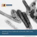 Marburg-Virus-Outbreak-in-Rwanda:-800-Cases-Reported-The-Aartery-Chronicles-TAC