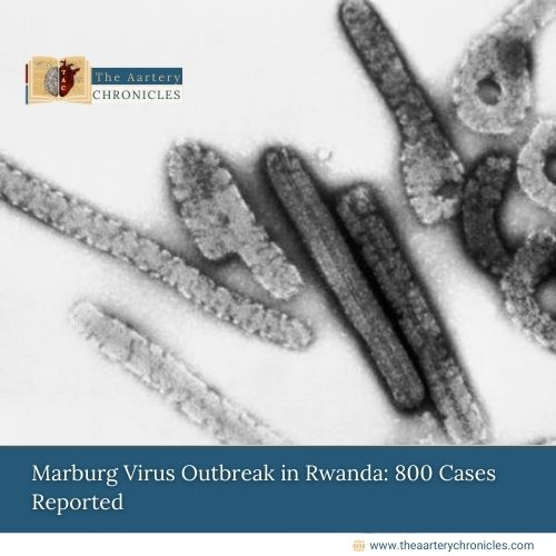 Marburg Virus Outbreak in Rwanda: 800 Cases Reported