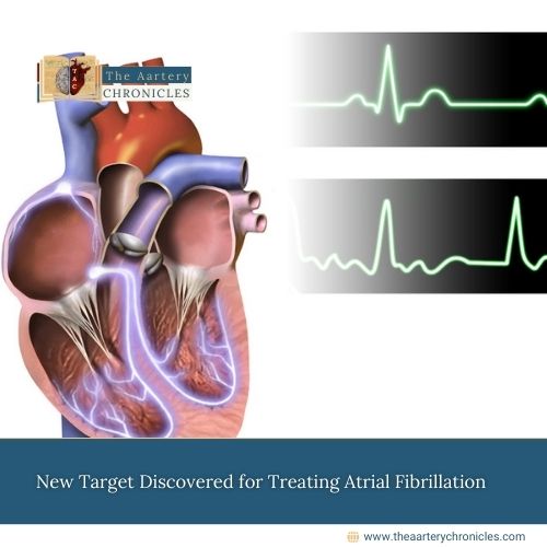 New Target Discovered for Treating Atrial Fibrillation