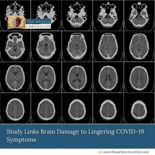 Study Links Brain Damage to Lingering COVID-19 Symptoms