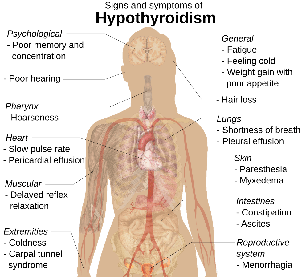 The-Impact-of-Hypothyroidism:-How-to-Recognize-and-Manage-It-The-Aartery-Chronicles-TAC