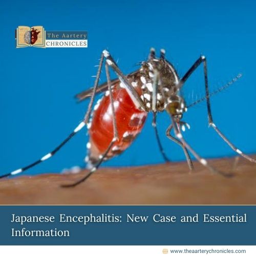 Japanese-Encephalitis:-New-Case-and-Essential-Information-The-Aartery-Chronicles-TAC