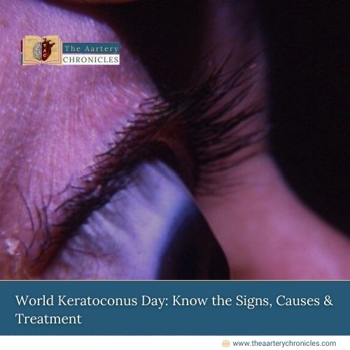 World-Keratoconus-Day:-Know-the-Signs,-Causes-&-Treatment-The-Aartery-Chronicles-TAC