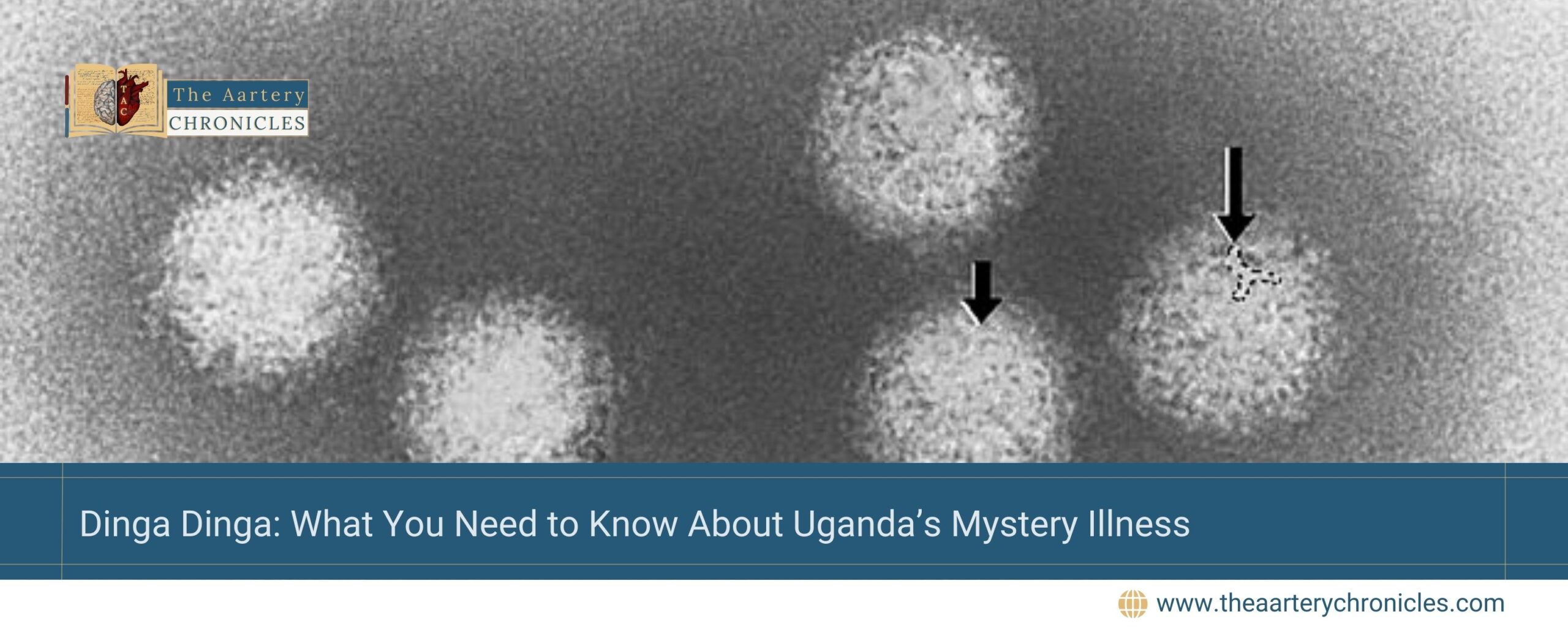 Dinga-Dinga:-What-You-Need-to-Know-About-Uganda’s-Mystery-Illness-the-Aartery-Chronicles-TAC