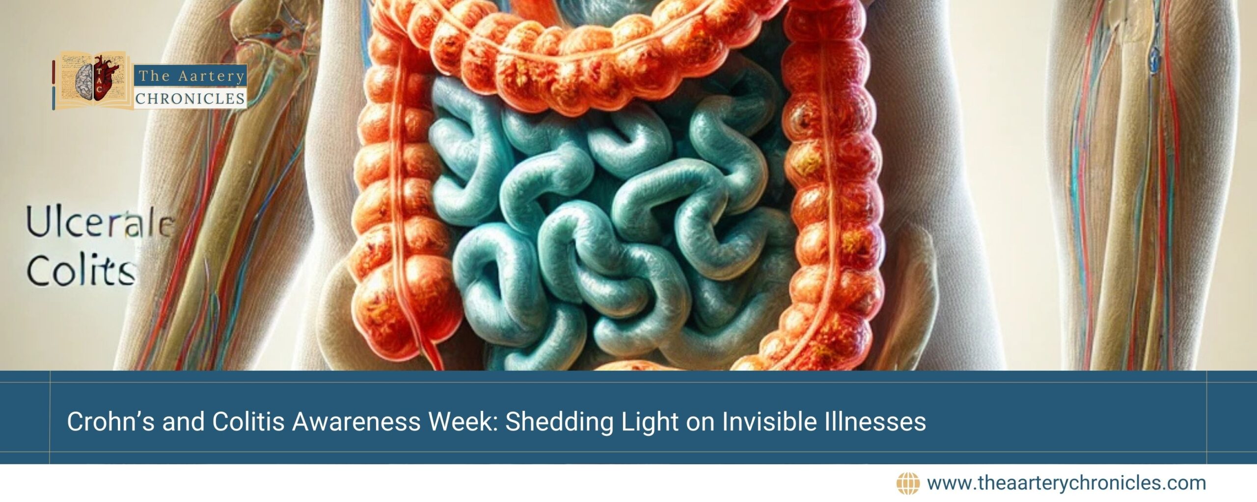 Crohn’s-and-Colitis-Awareness-Week:-Shedding-Light-on-Invisible-Illnesses-The-Aartery-Chronicles-TAC