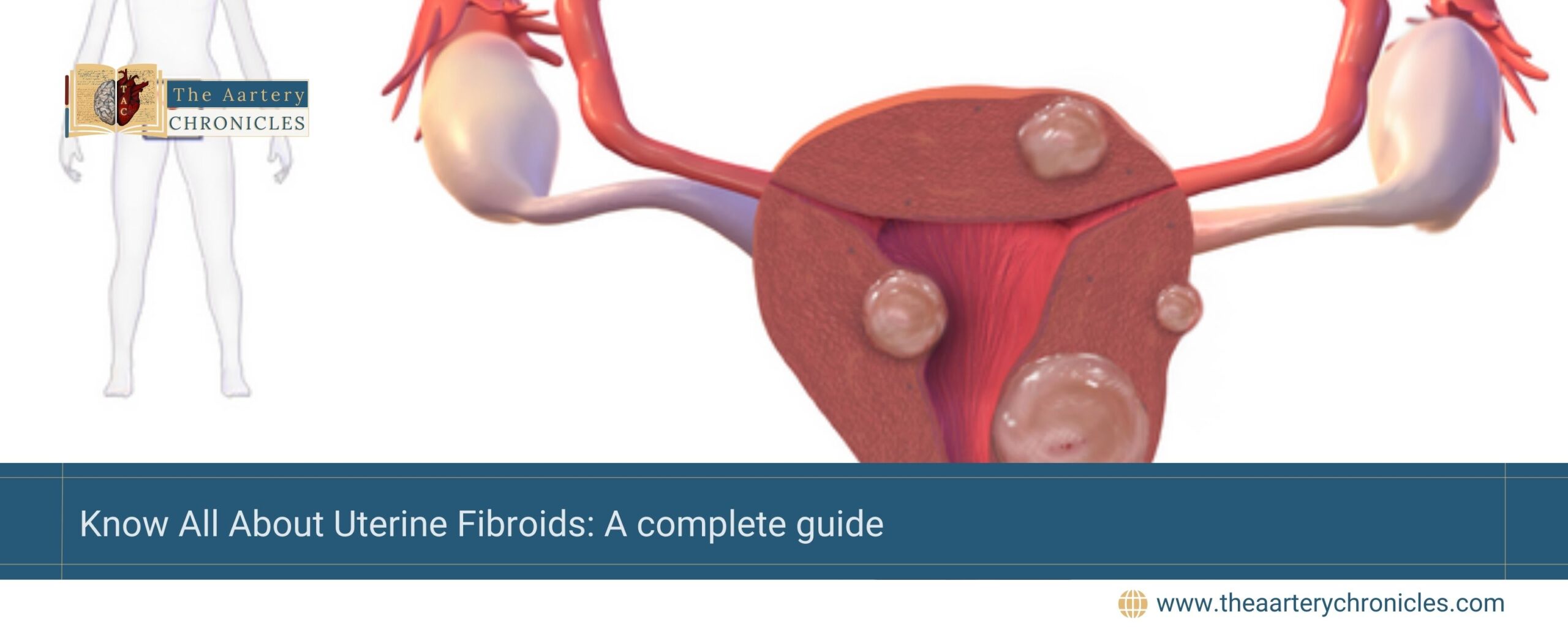 Know-All-About-Uterine-Fibroids:-A-complete-guide-The-Aartery-Chronicles-TAC