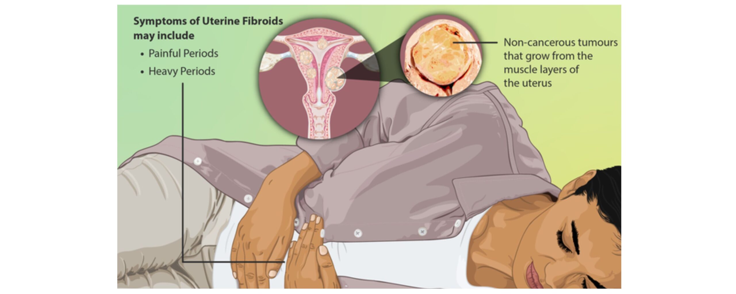 Know-All-About-Uterine-Fibroids:-A-complete-guide-The-Aartery-Chronicles-TAC