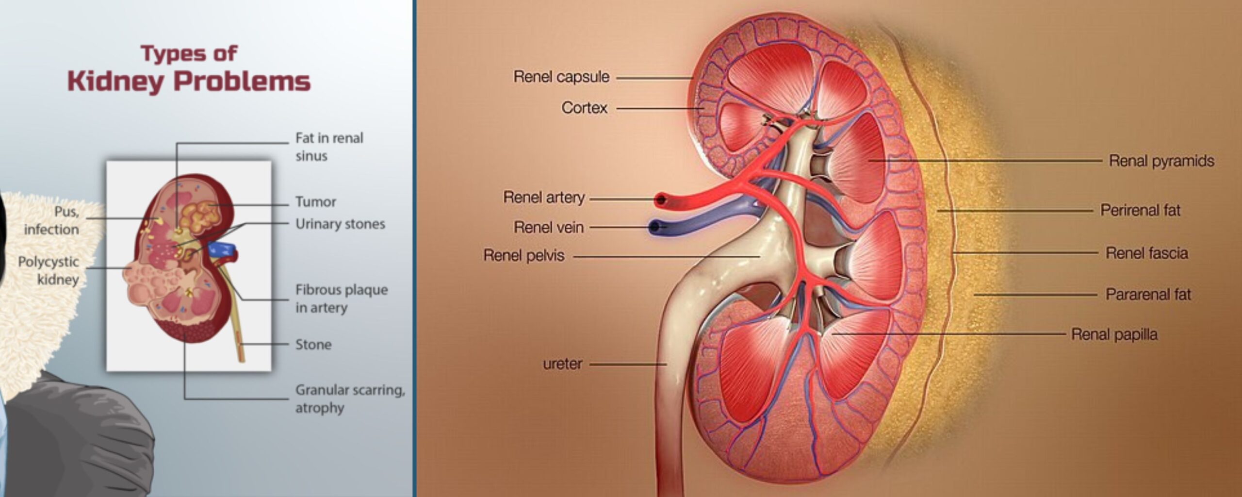 Everything-You-Need-to-Know-About-Chronic-Kidney-Disease-(CKD)-The-Aartery-Chronicles-TAC