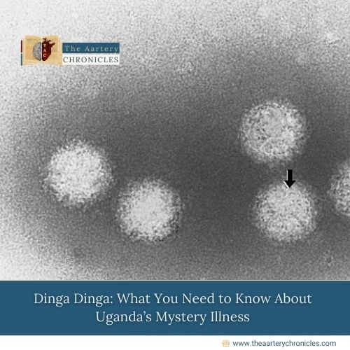 Dinga Dinga: What You Need to Know About Uganda’s Mystery Illness