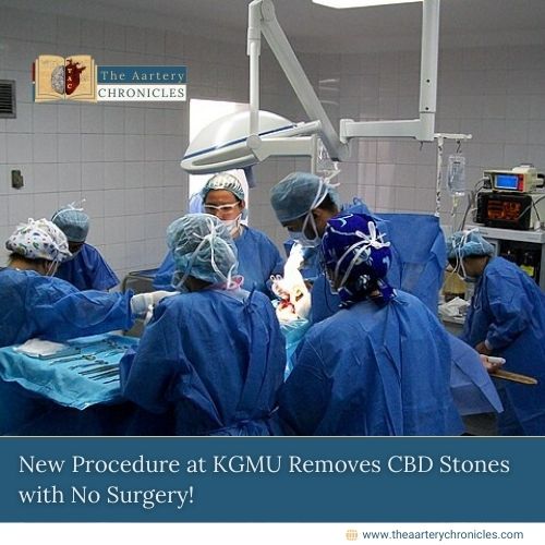 New Procedure at KGMU Removes CBD Stones with No Surgery!