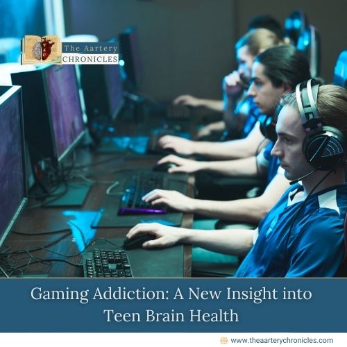 gaming-addiction-a-new-insight-into-teen-brain-health-the-aartery-chronicles-tac