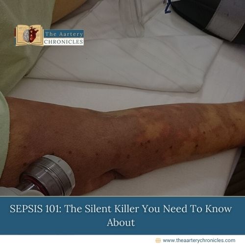 SEPSIS-101:-The-Silent-Killer-You-Need-To-Know-About-The-Aartery-Chronicles-TAC