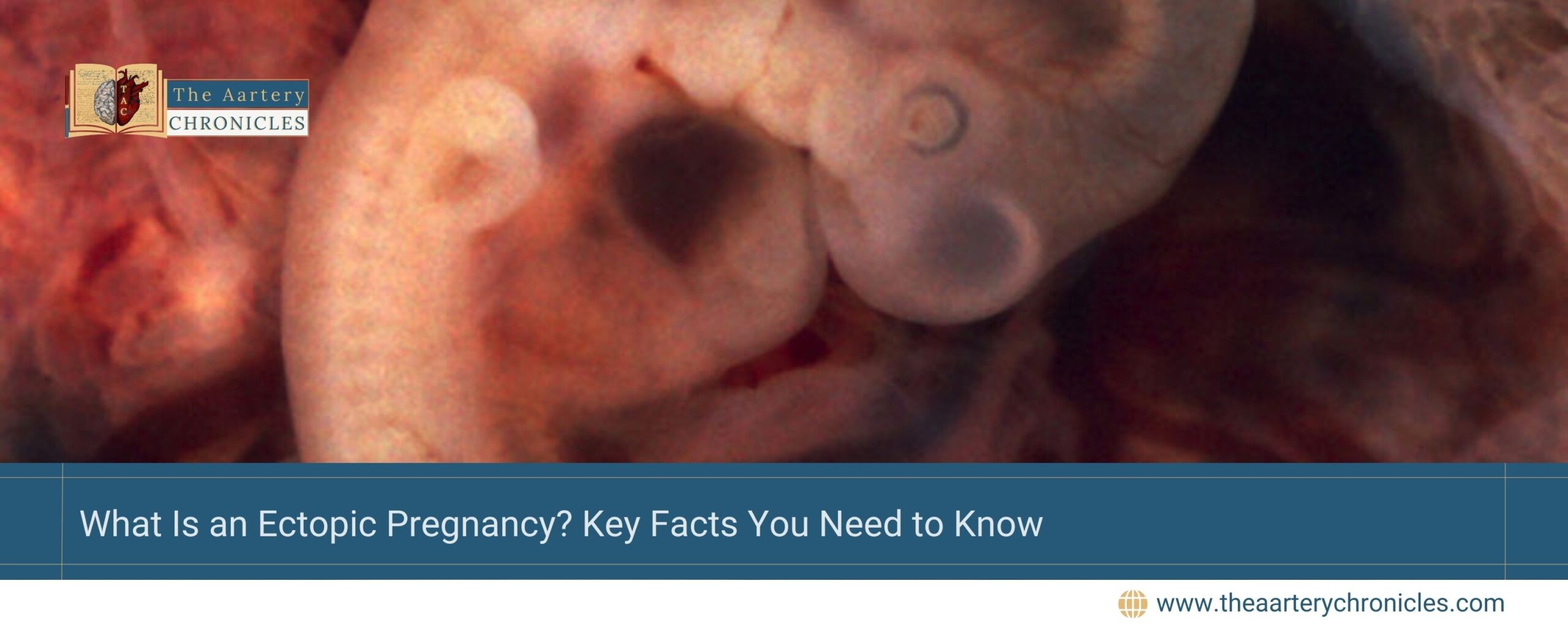 What-Is-an-Ectopic-Pregnancy?-Key-Facts-You-Need-to-Know-The-Aartery-Chronicles-TAC