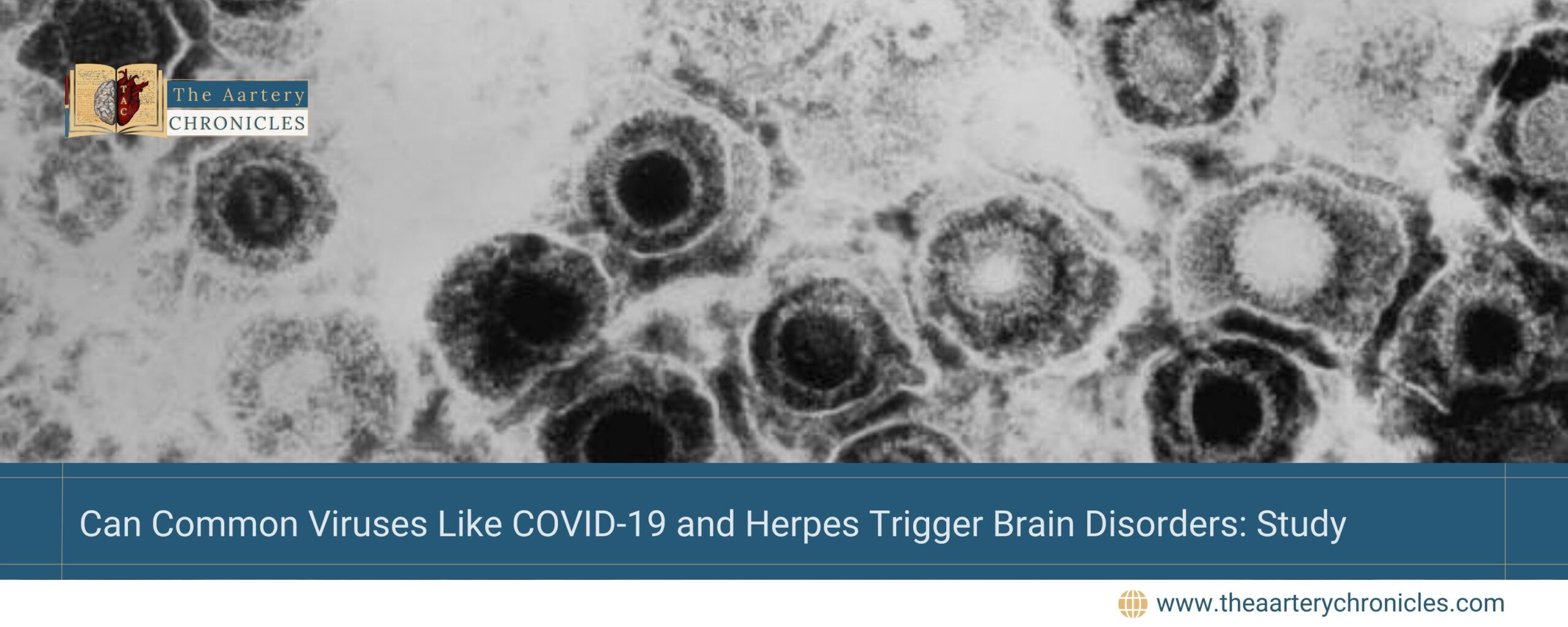 Can-Common-Viruses-Like-COVID-19-and-Herpes-Trigger-Brain-Disorders:-Study-The-Aartery-Chronicles-TAC