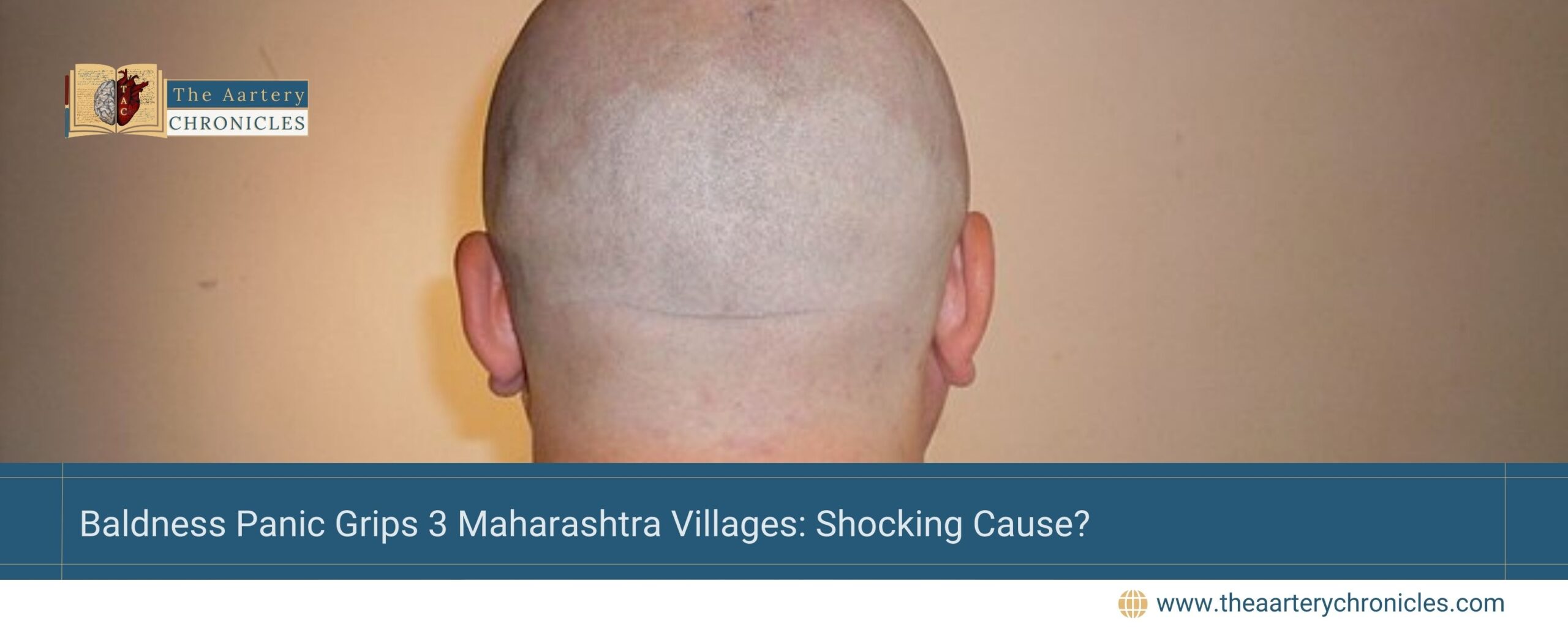 Baldness Panic Grips 3 Maharashtra Villages: Shocking Cause?