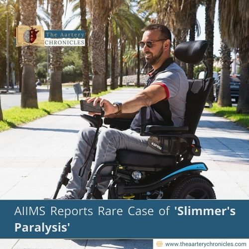 AIIMS Reports Rare Case of 'Slimmer's Paralysis'