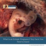 What-Is-an-Ectopic-Pregnancy?-Key-Facts-You-Need-to-Know-The-Aartery-Chronicles-TAC