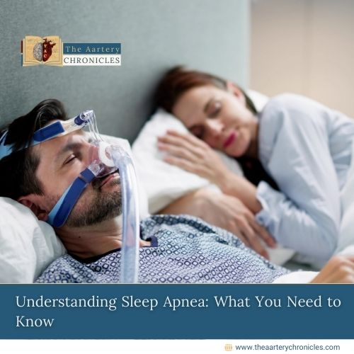 Understanding Sleep Apnea: What You Need to Know